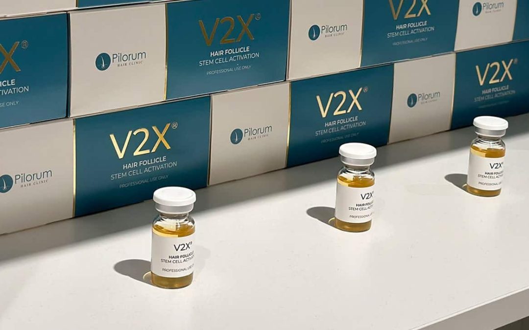 V2X behandling